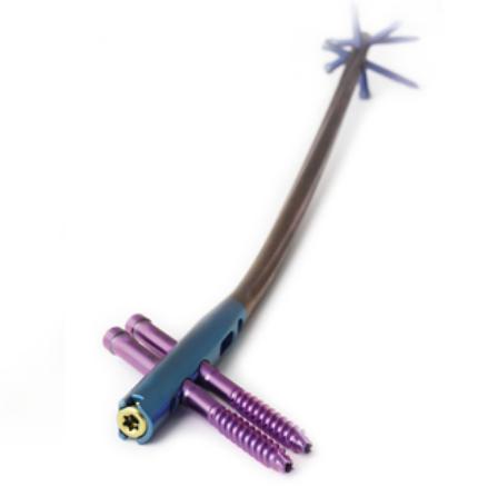 Стержень анатомічний для інтрамедулярного остеосинтезу стегнової кістки Charfix2